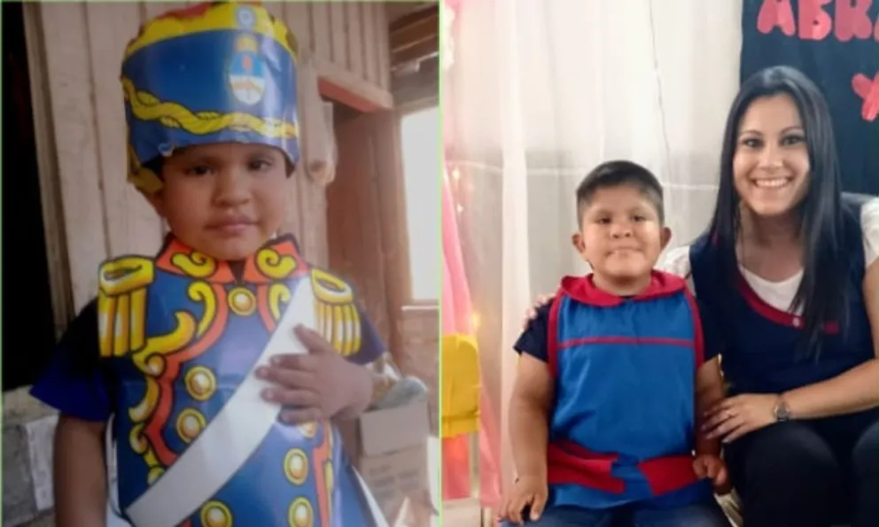 Solidaridad: Un niño de 5 años necesita adquirir dos implantes