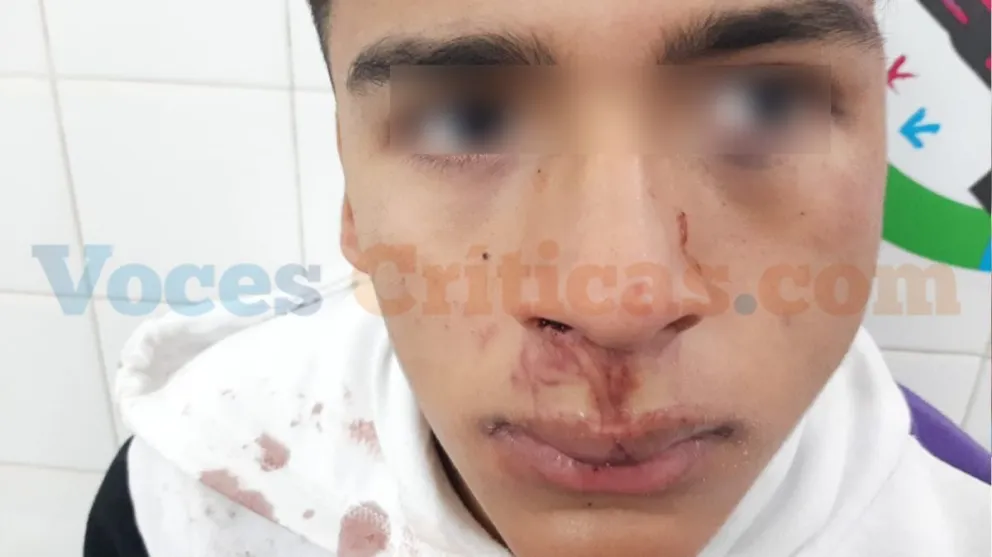 |FOTOS Y VIDEO| Sangre, violencia y horror en Orán: la policía propinó una brutal paliza a un menor