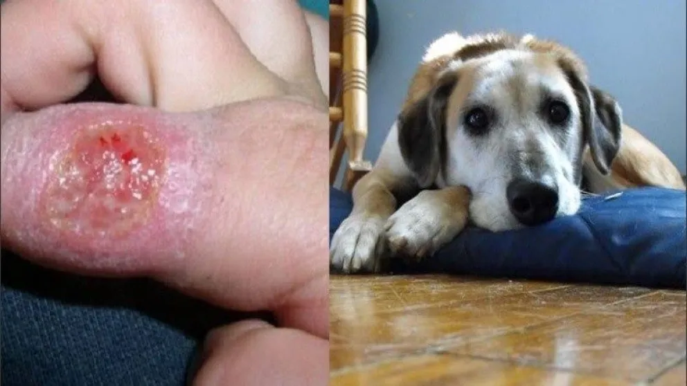 Leishmaniasis Salta.